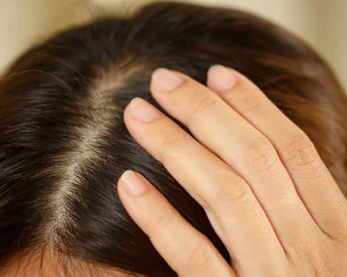 Transform Your Tresses: New Hair Loss Treatments to Love