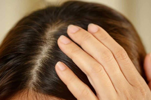 Transform Your Tresses: New Hair Loss Treatments to Love